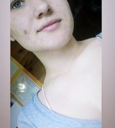 Богдана, 20 лет, Женщина, Геническ, Украина